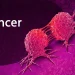 Cancer on rise in J&K: GIT cancers most common, smoking, pollution, change in lifestyle main causes, say experts