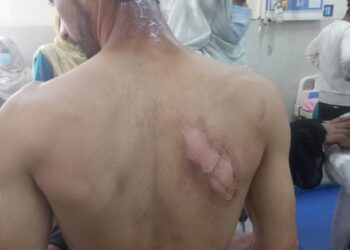 Four Persons Injured In LPG Cylinder Blast In Kupwara