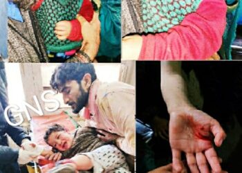 Stray Dogs Unleash Terror, Injure Nearly A Dozen in Lolab Areas