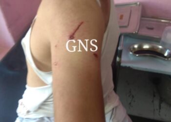 Man Injured In Leopard Attack In Nesbal Bandipora