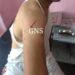 Man Injured In Leopard Attack In Nesbal Bandipora