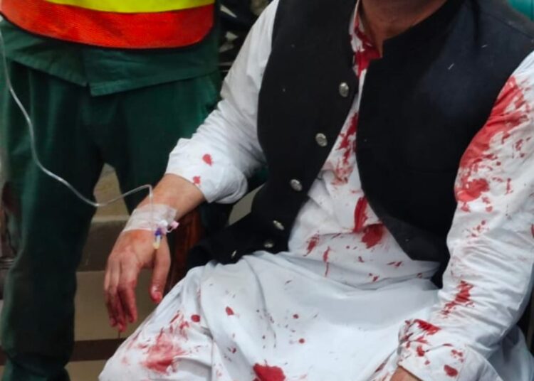 Imran Khan: Pakistan’s former prime minister injured in shooting