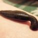 On Navroz, Leech therapy still popular in Kashmir