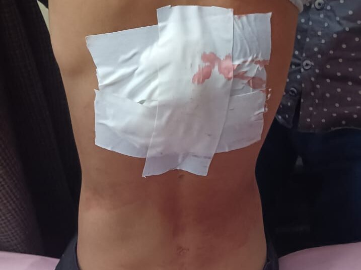 Youth Grievously Injured After Stabbed During Altercation in Sopore