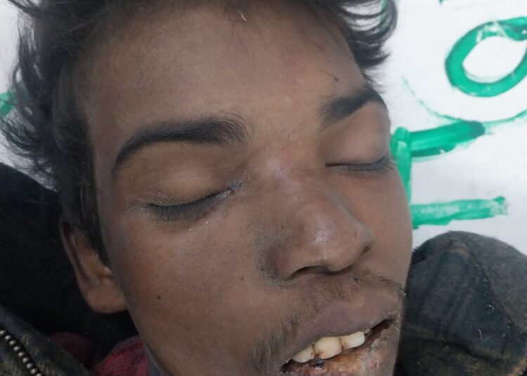 Unidentified Dead Body Found At Railway Crossing In Nowgam