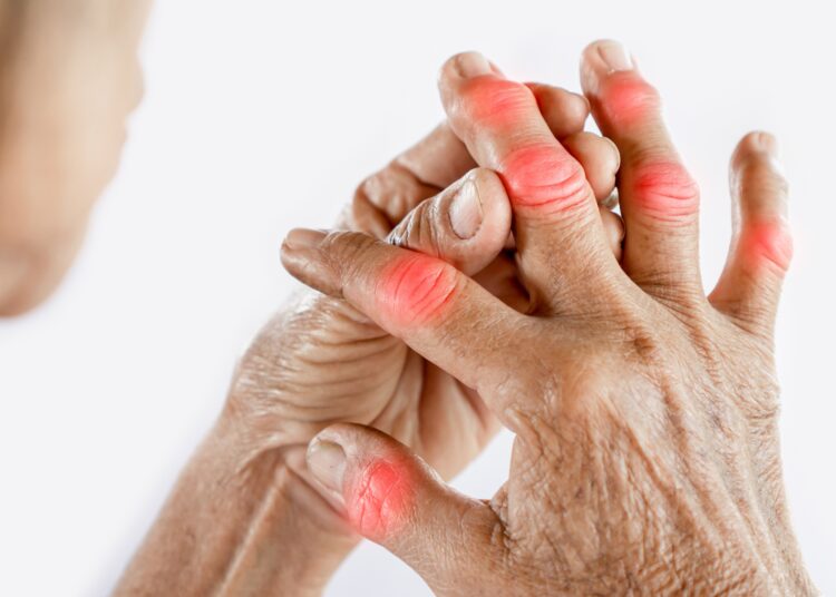 World Arthritis Day: Experts stress urgent need for awareness, prevention